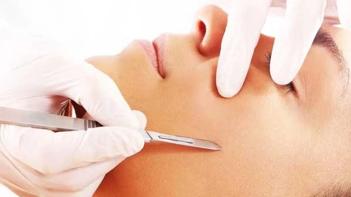 Dermaplanning
